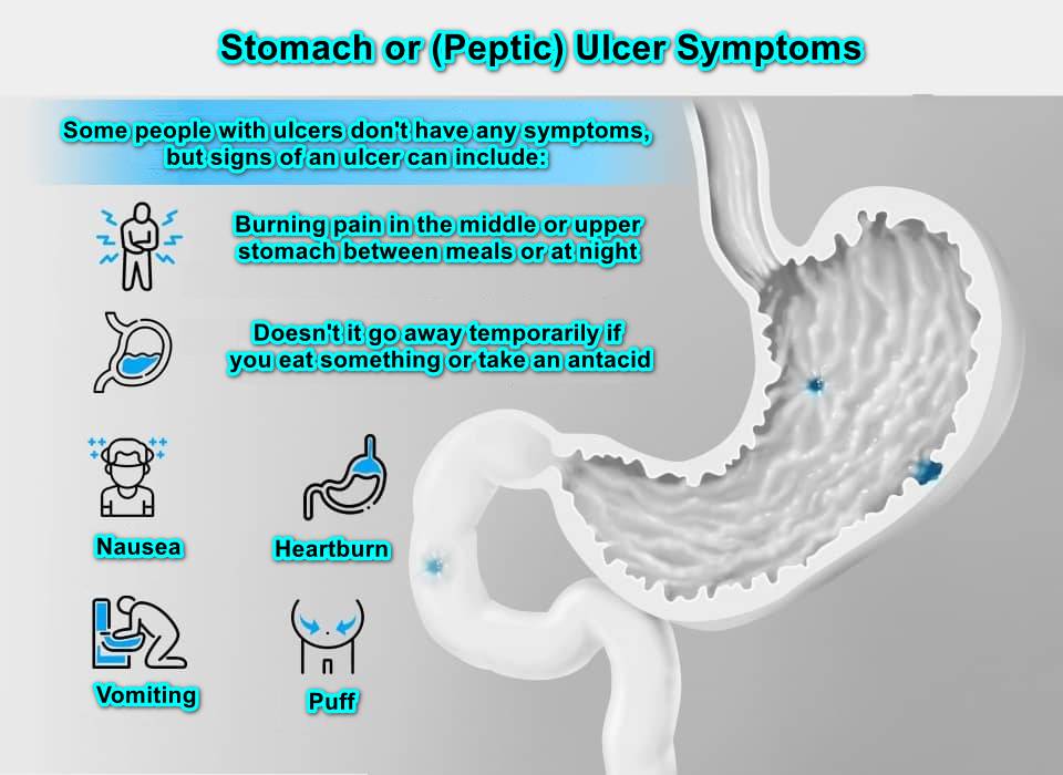 Stomach or (Peptic) Ulcer Symptom and treatment in Iran city of Shiraz