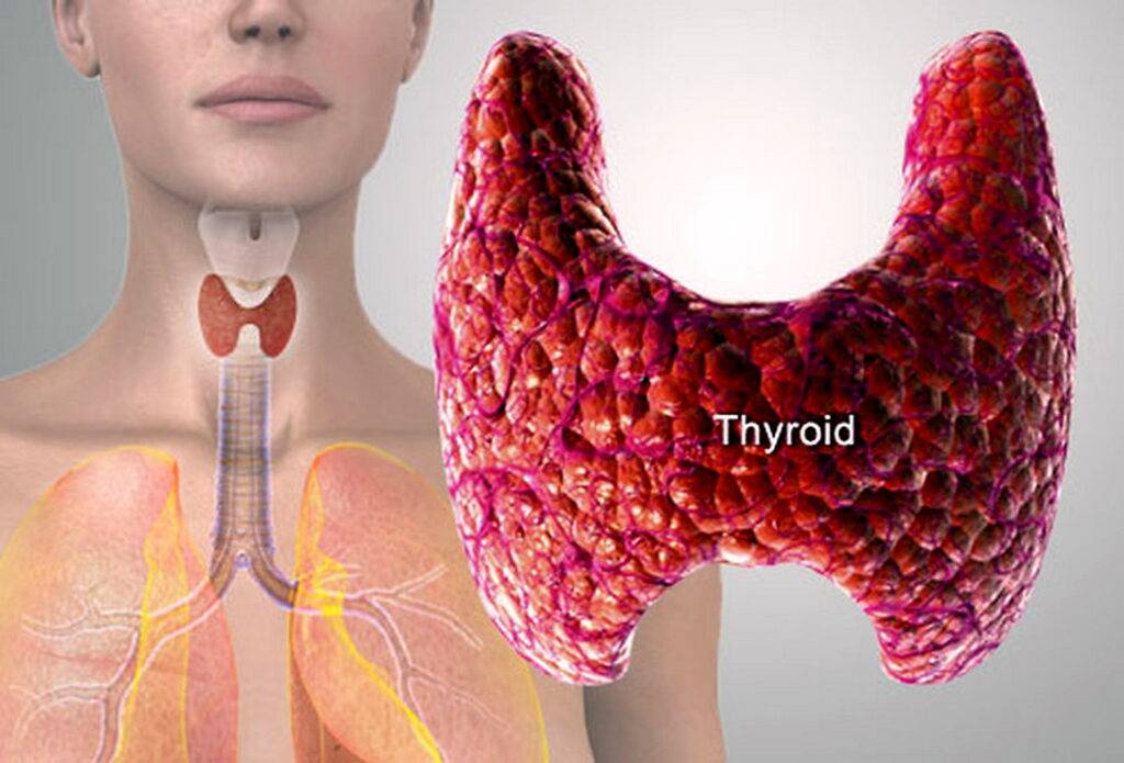 Thyroid diseases, symptoms and treatment in Iran