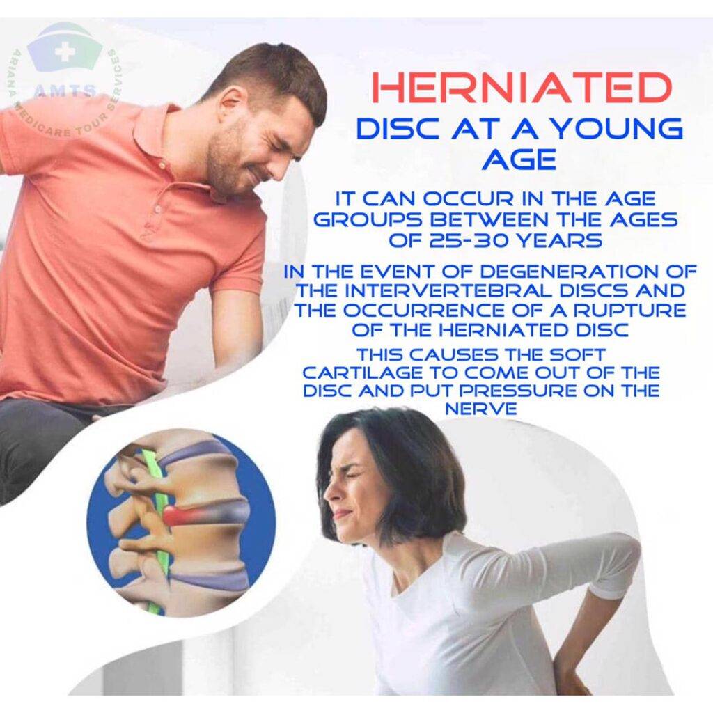 herniated disc at a young age