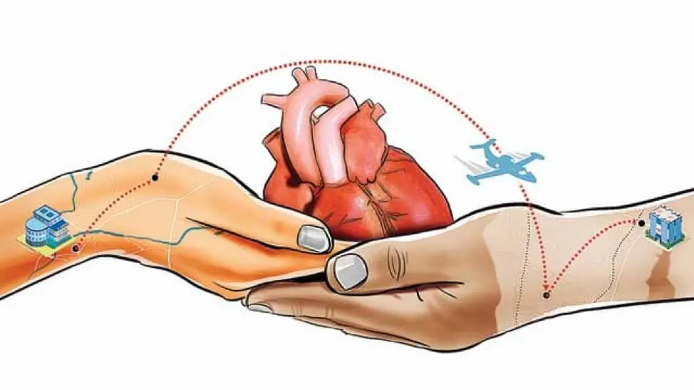 إجراء عملية زرع القلب في أسرع وقتممكن بعد العثور علي قلب متبرع