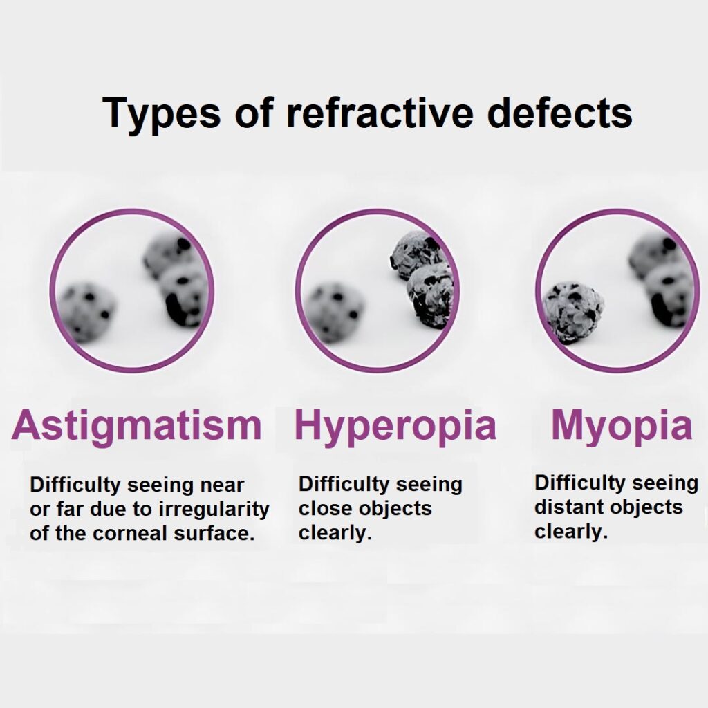 Types of refractive defects